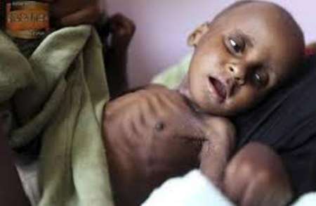 یونیسف: ۶ هزار کودک یمنی از آغاز جنگ کشته شده‌اند/ مرگ یک کودک در هر ۱۰ دقیقه